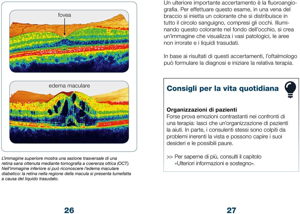 Illuminando questo colorante nel fondo dell occhio, si crea un immagine che visualizza i vasi patologici, le aree non irrorate e i liquidi trasudati.