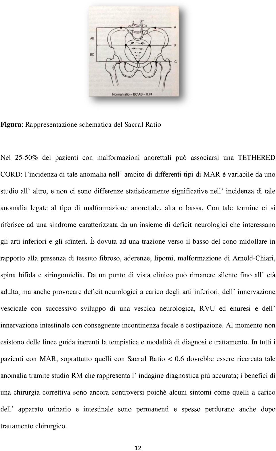 Con tale termine ci si riferisce ad una sindrome caratterizzata da un insieme di deficit neurologici che interessano gli arti inferiori e gli sfinteri.