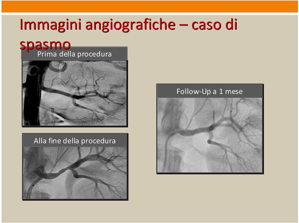 della procedura Follow-Up