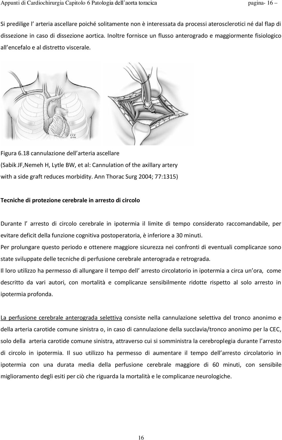 18 cannulazione dell arteria ascellare (Sabik JF,Nemeh H, Lytle BW, et al: Cannulation of the axillary artery with a side graft reduces morbidity.