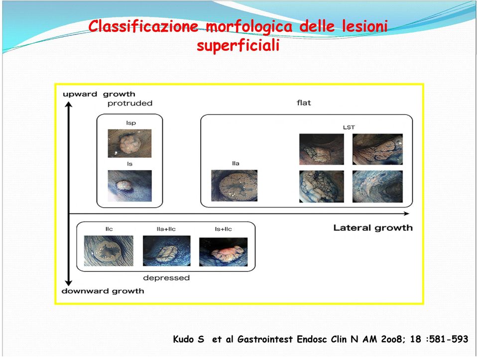 Kudo S et al Gastrointest