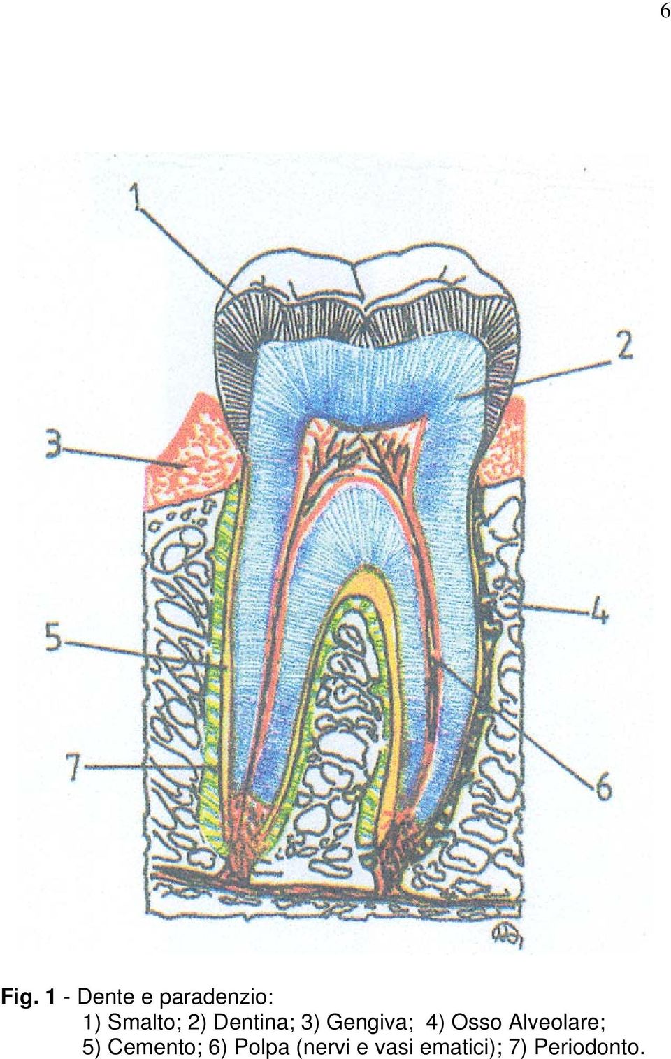 Osso Alveolare; 5) Cemento; 6)