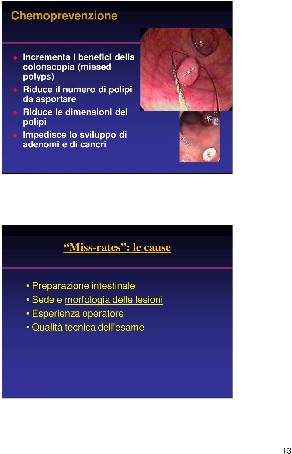 sviluppo di adenomi e di cancri Miss-rates : le cause Preparazione intestinale