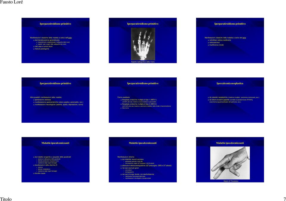 della mano Ipercalcemia neoplastica Altre possibili manifestazioni della malattia: ipertensione arteriosa manifestazione gastroenteriche (ulcera peptica, pancreatite, ecc.