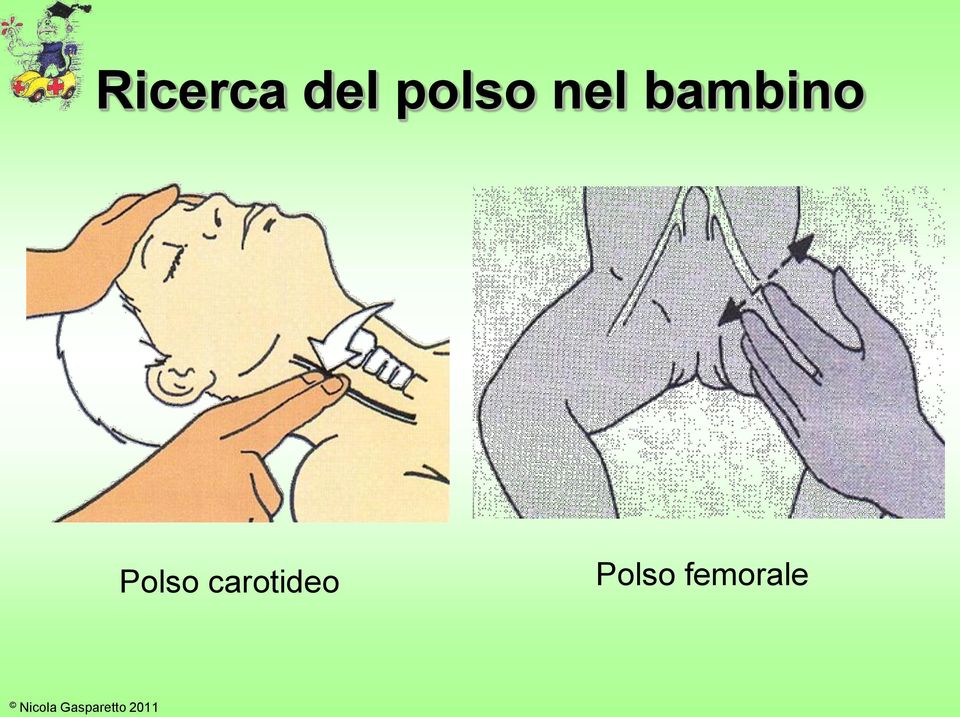 bambino Polso