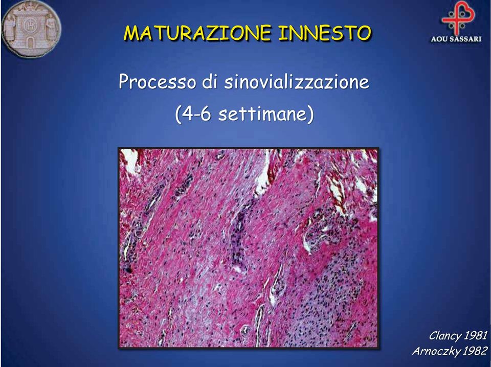 sinovializzazione (4-6