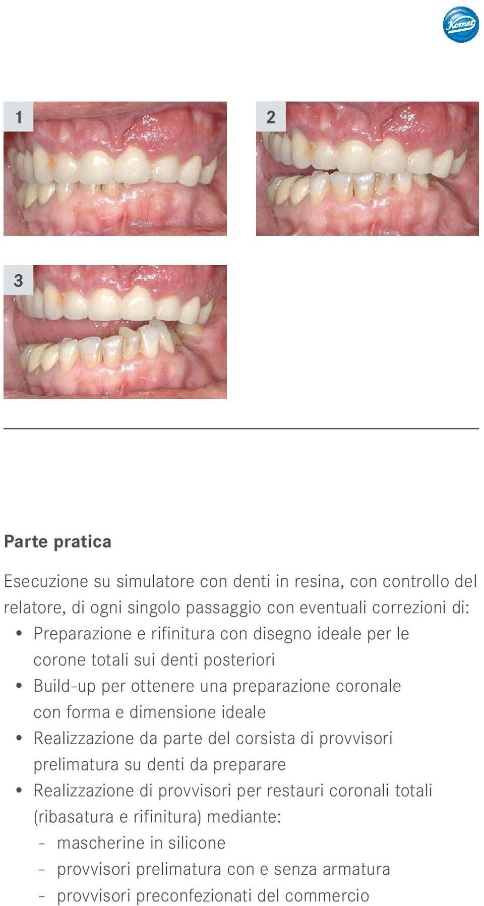 dimensione ideale Realizzazione da parte del corsista di provvisori prelimatura su denti da preparare Realizzazione di provvisori per restauri