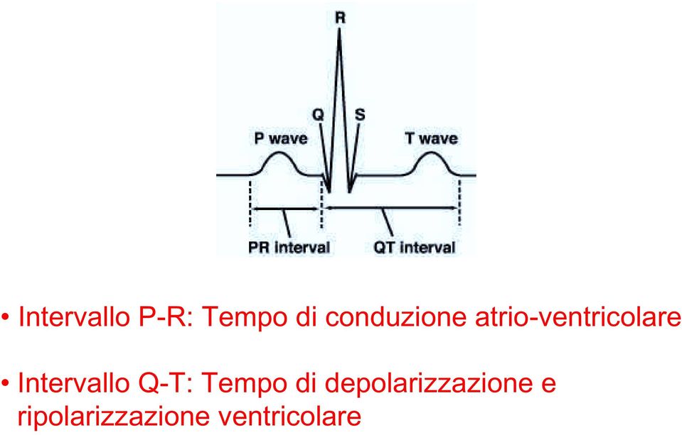 Intervallo QT: Tempo di