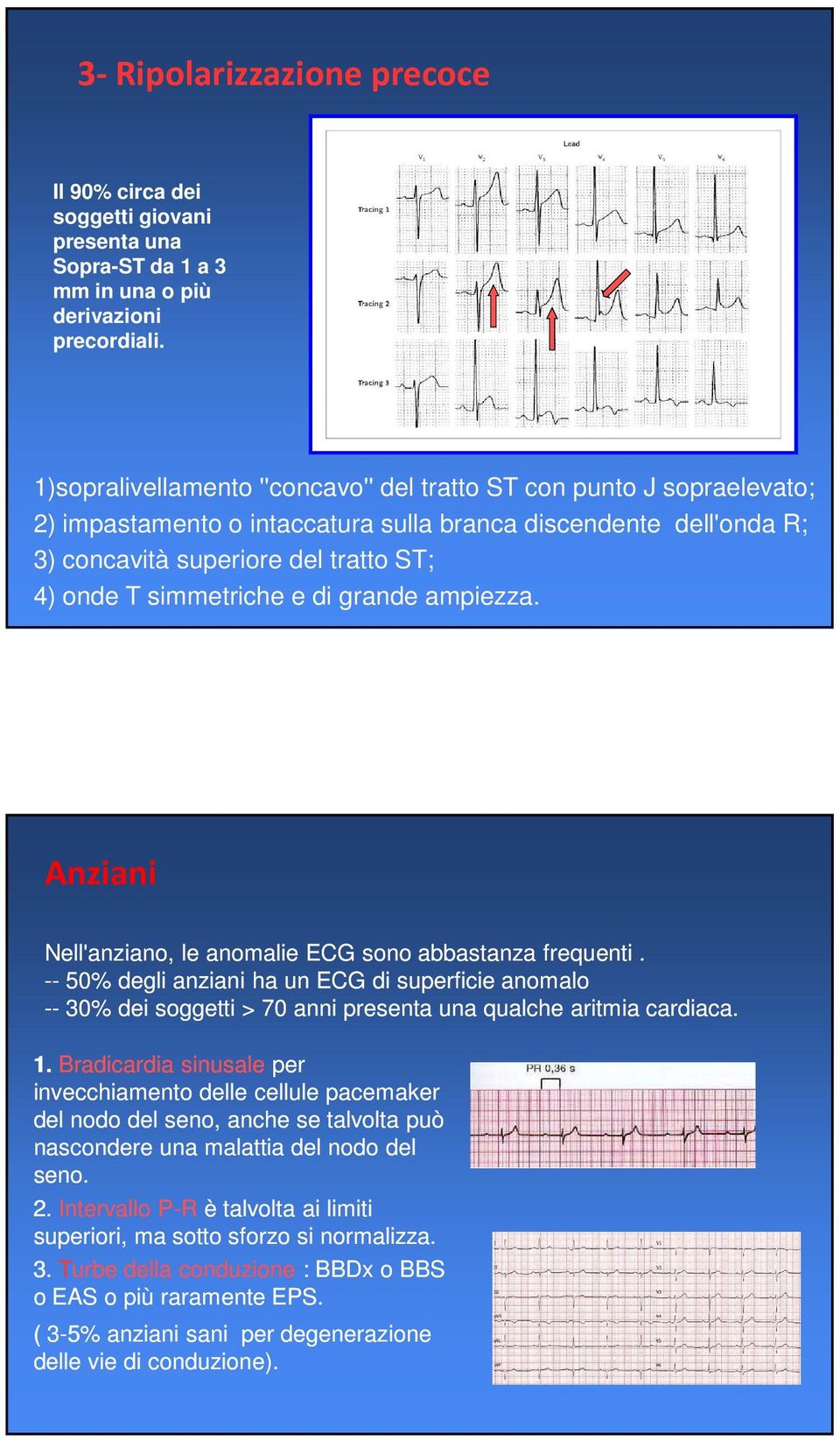 e di grande ampiezza. Anziani Nell'anziano, le anomalie ECG sono abbastanza frequenti.