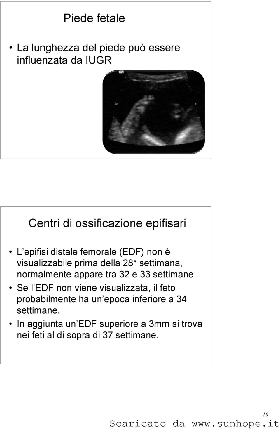 tra 32 e 33 settimane Se l EDF non viene visualizzata, il feto probabilmente ha un epoca inferiore a