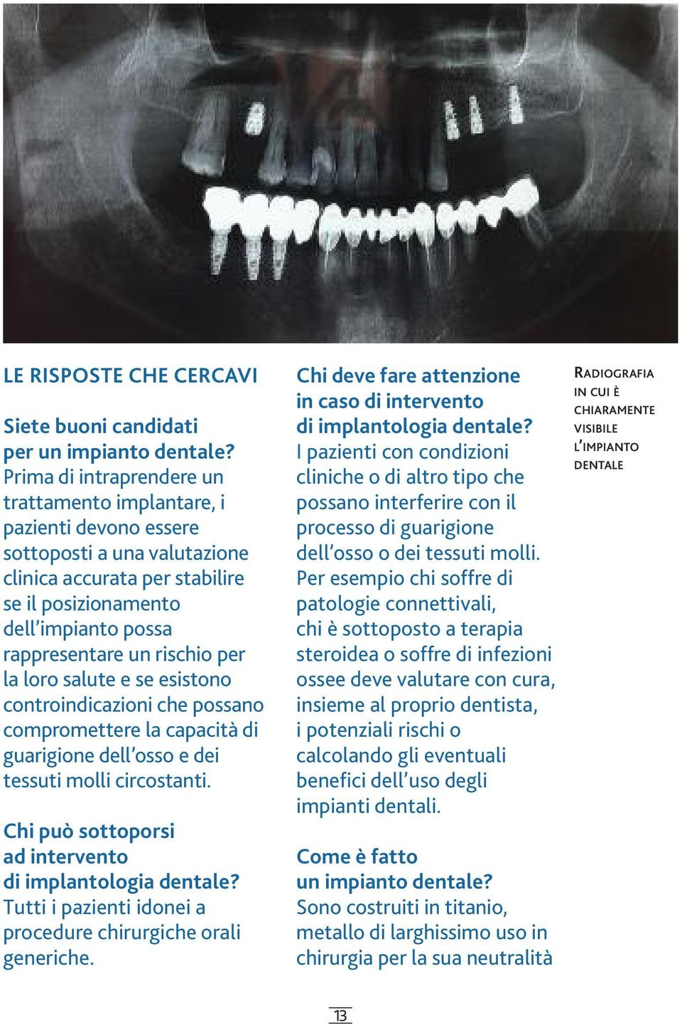 rischio per la loro salute e se esistono controindicazioni che possano compromettere la capacità di guarigione dell osso e dei tessuti molli circostanti.