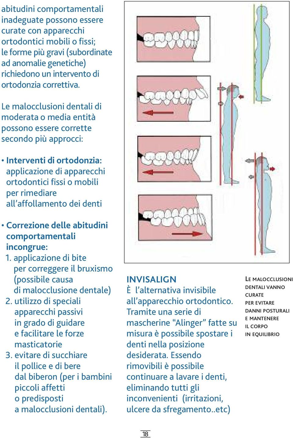 Le malocclusioni dentali di moderata o media entità possono essere corrette secondo più approcci: Interventi di ortodonzia: applicazione di apparecchi ortodontici fissi o mobili per rimediare all