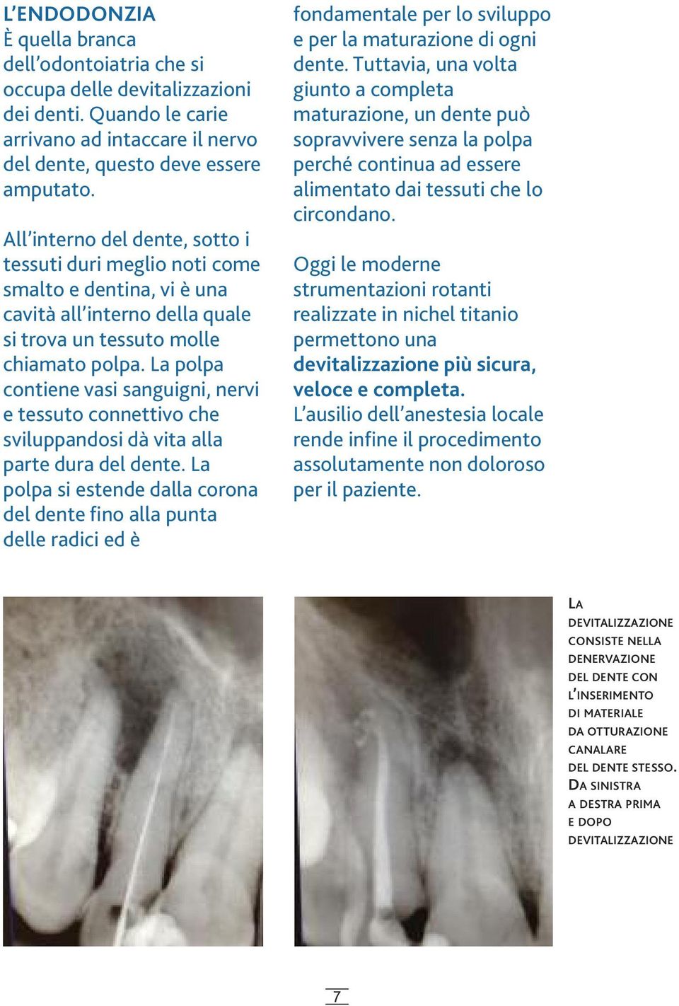 La polpa contiene vasi sanguigni, nervi e tessuto connettivo che sviluppandosi dà vita alla parte dura del dente.