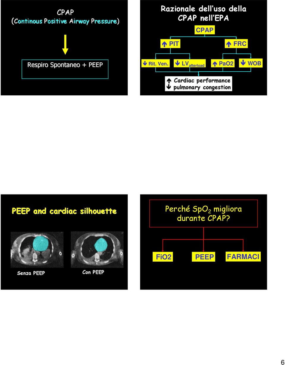 LV afterload PaO2 WOB Cardiac performance pulmonary congestion PEEP and