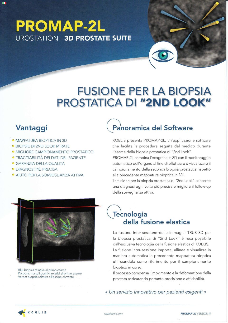 campionamento della seconda biopsia postatica ispetto alla pecedente mappatua bioptica in 3D La fusìone pe la biopsia postatica di "2nd Look" consente una diagnosi ogni volta più pecisa e miglioa il