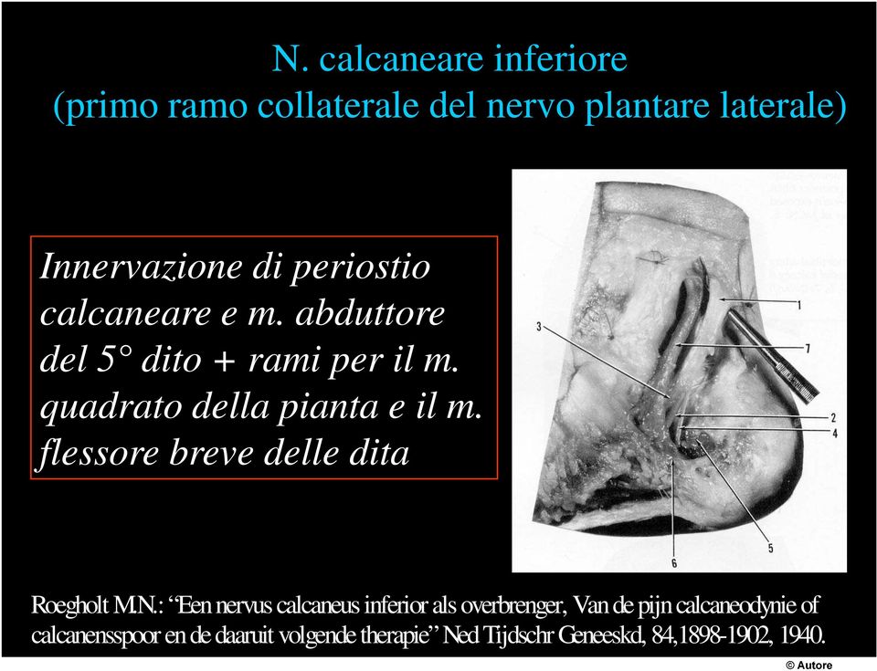 flessore breve delle dita Roegholt M.N.