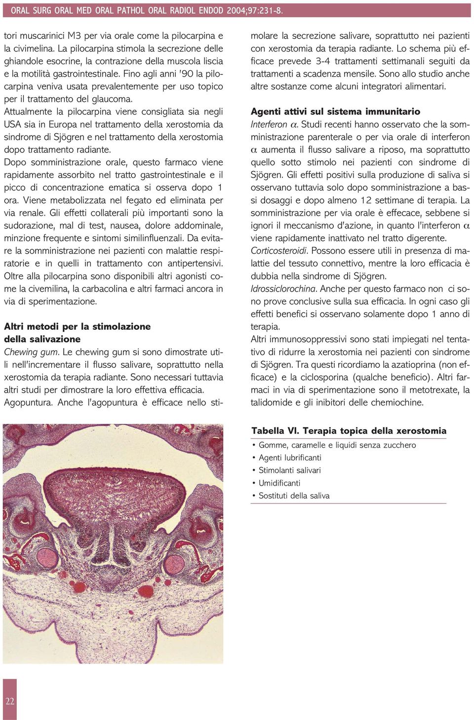 Fino agli anni 90 la pilocarpina veniva usata prevalentemente per uso topico per il trattamento del glaucoma.