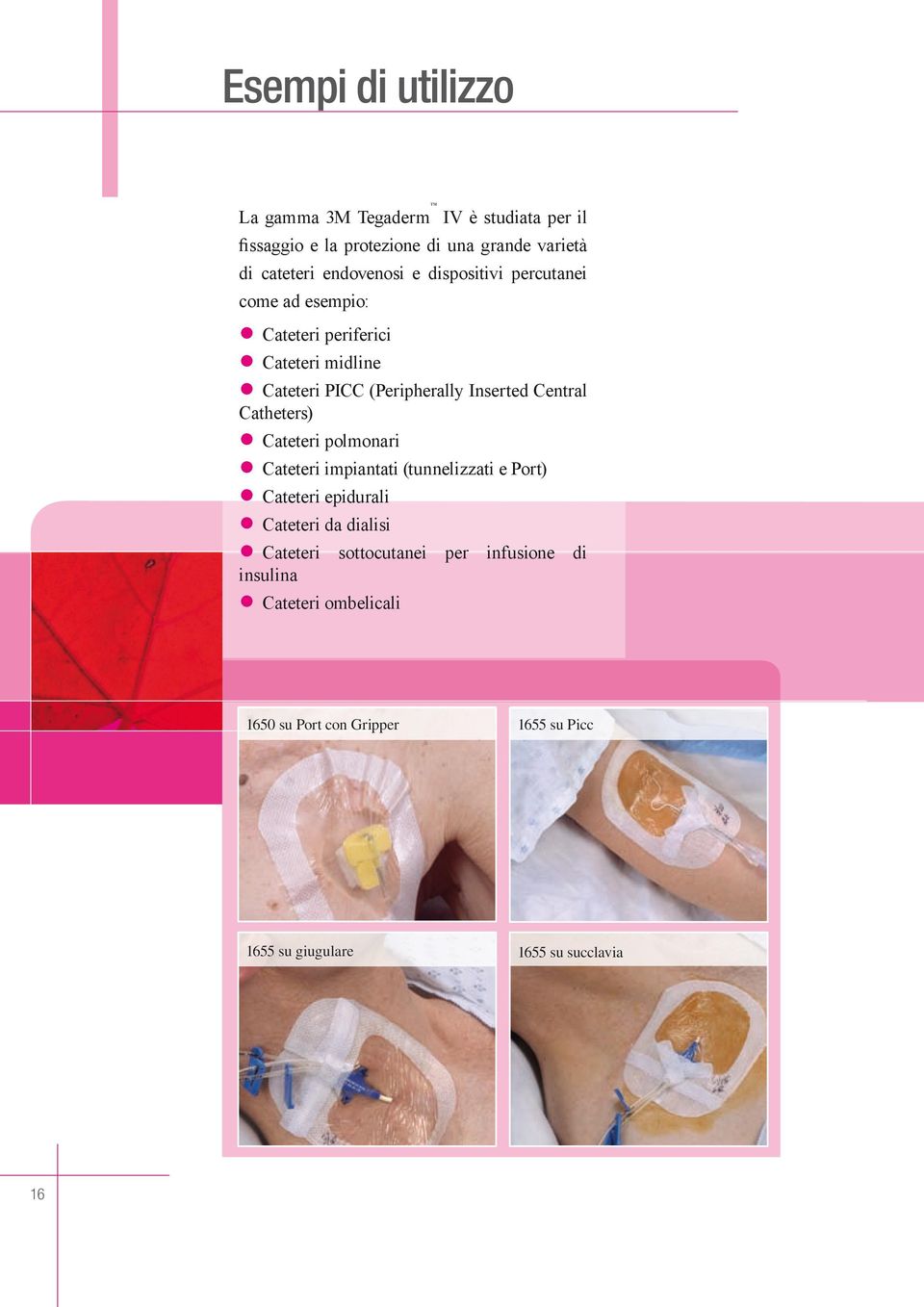 Central Catheters) Cateteri polmonari Cateteri impiantati (tunnelizzati e Port) Cateteri epidurali Cateteri da dialisi Cateteri