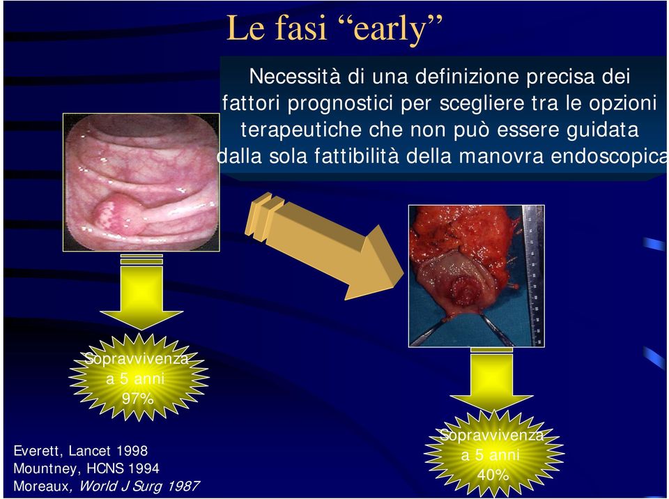 fattibilità della manovra endoscopica Sopravvivenza a 5 anni 97% Everett,