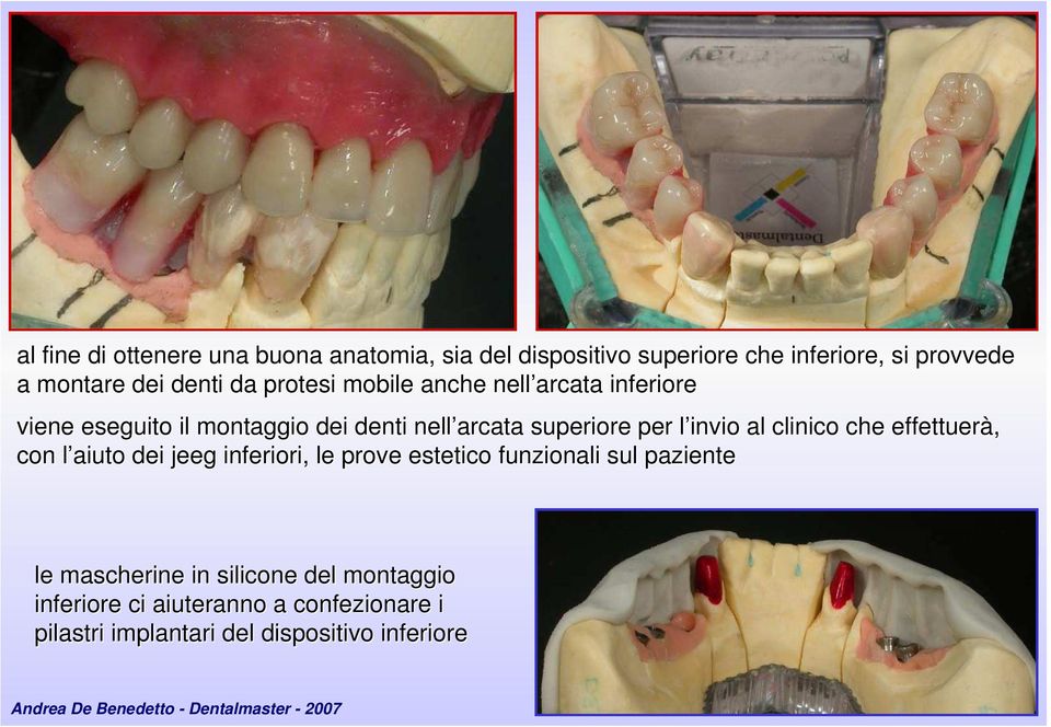 che effettuerà, con l aiuto dei jeeg inferiori, le prove estetico funzionali sul paziente le mascherine in silicone del