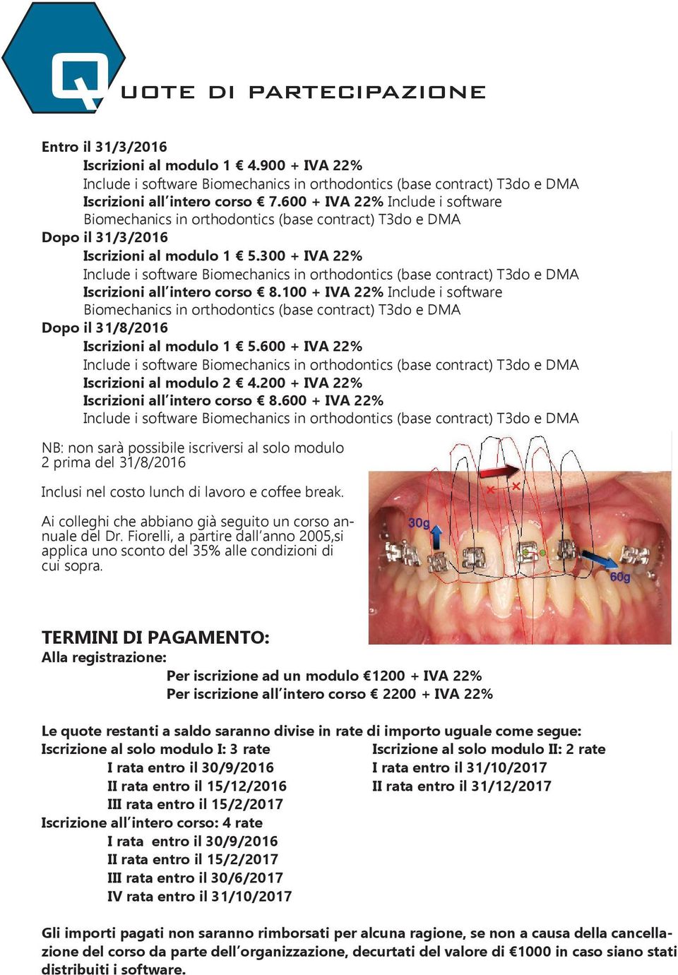 300 + IVA 22% Include i software Biomechanics in orthodontics (base contract) T3do e DMA Iscrizioni all intero corso 8.