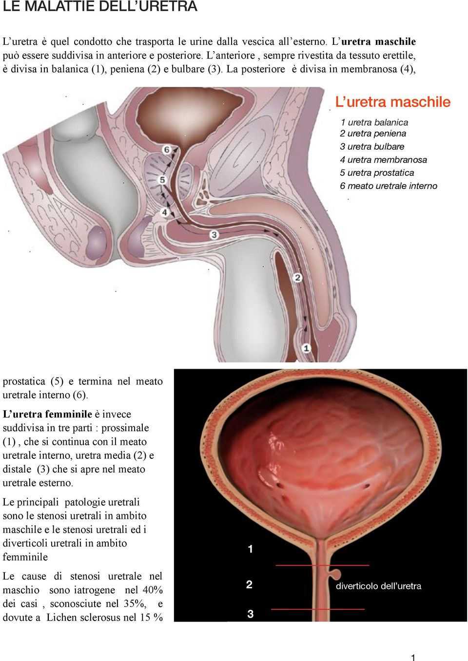 La posteriore è divisa in membranosa (4), L uretra maschile 1 uretra balanica 2 uretra peniena 3 uretra bulbare 4 uretra membranosa 5 uretra prostatica 6 meato uretrale interno prostatica (5) e