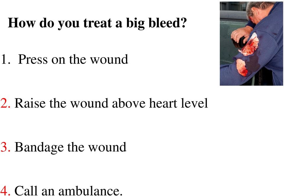 how to treat a big bleed 2.