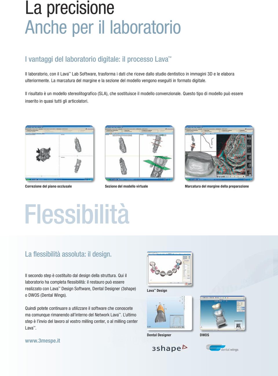 Il risultato è un modello stereolitografico (SLA), che sostituisce il modello convenzionale. Questo tipo di modello può essere inserito in quasi tutti gli articolatori.