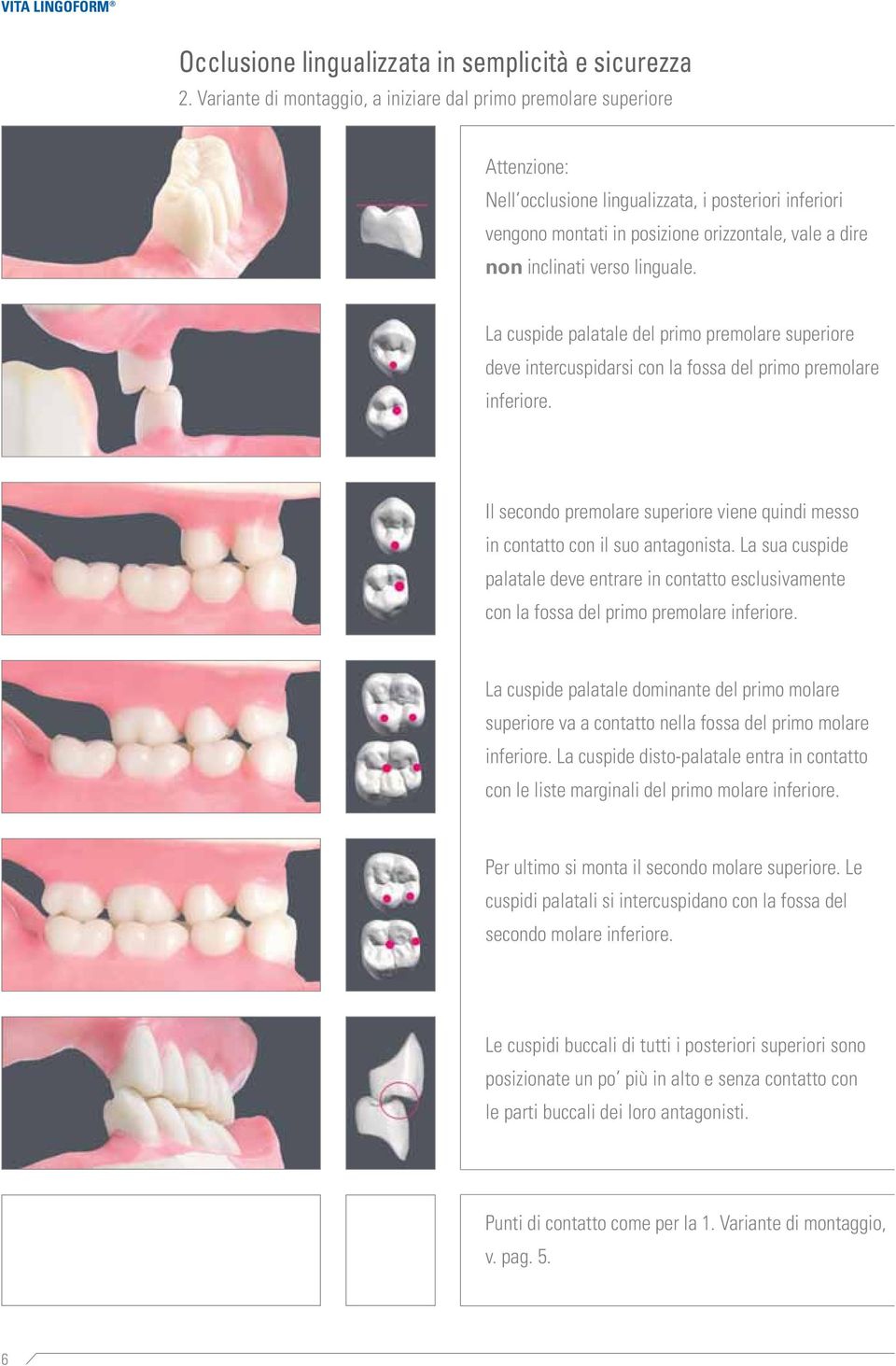 verso linguale. La cuspide palatale del primo premolare superiore deve intercuspidarsi con la fossa del primo premolare inferiore.
