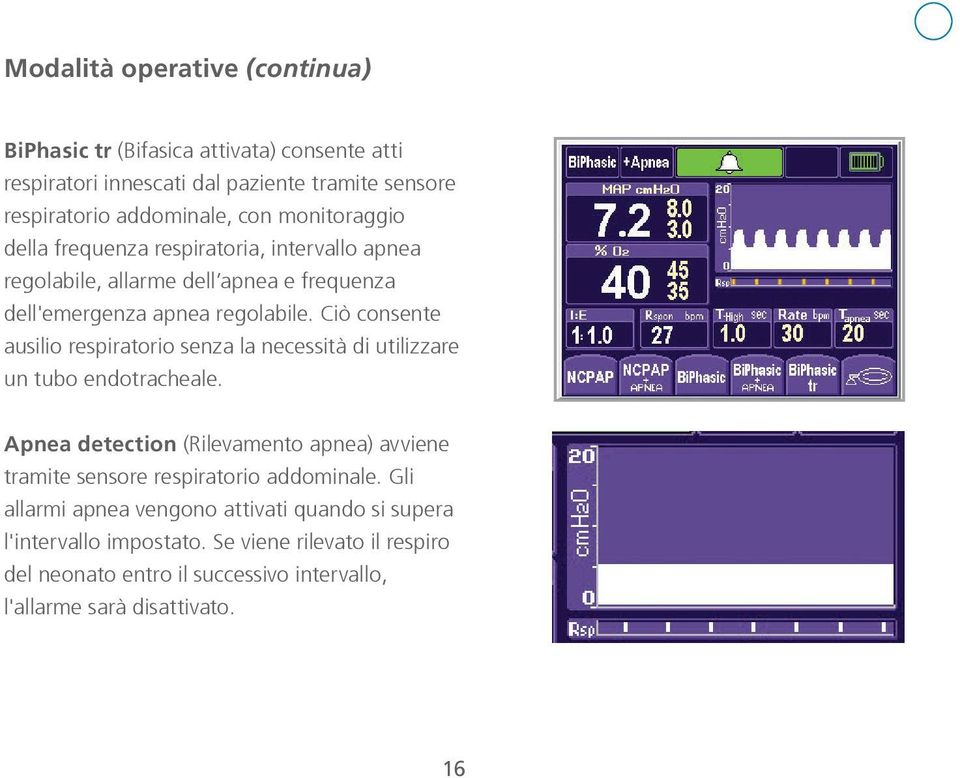 Ciò consente ausilio respiratorio senza la necessità di utilizzare un tubo endotracheale.