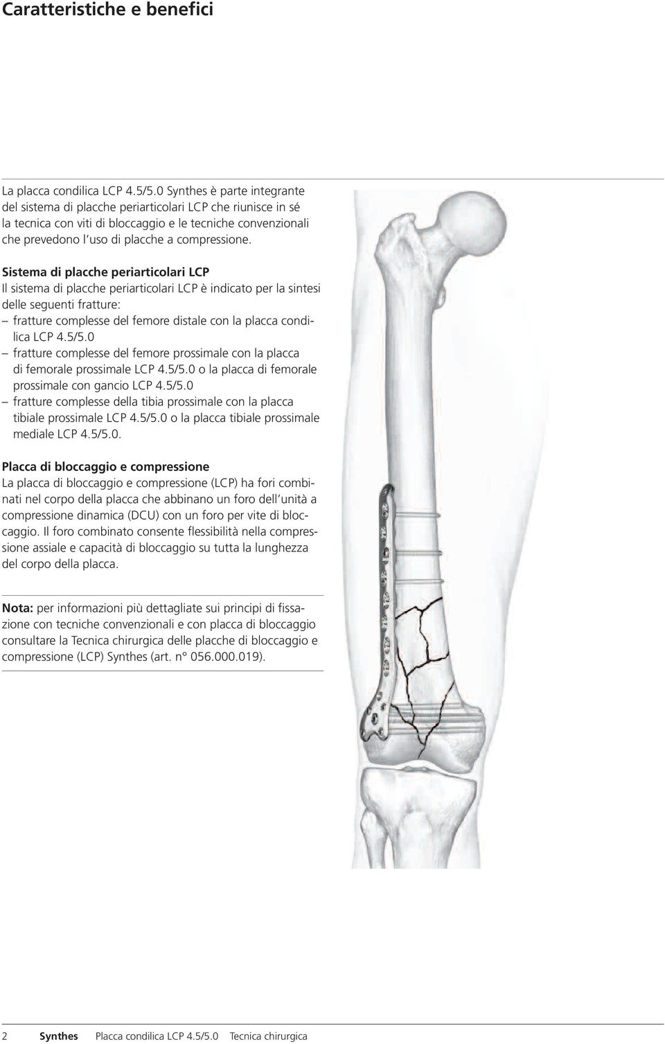 Sistema di placche periarticolari LCP Il sistema di placche periarticolari LCP è indicato per la sintesi delle seguenti fratture: fratture complesse del femore distale con la placca condilica LCP 4.