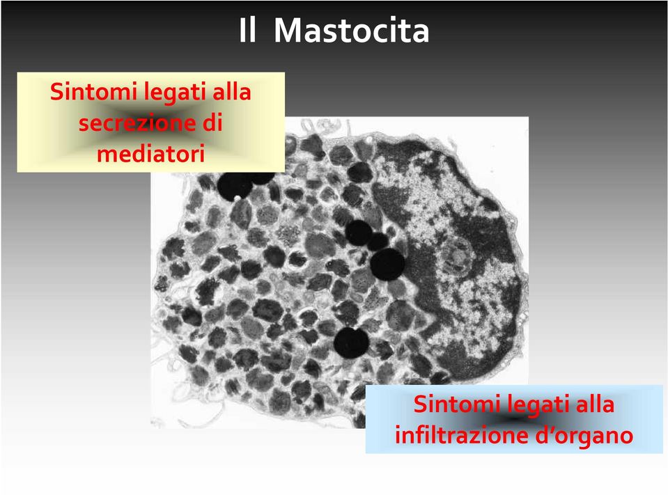 Il Mastocita 