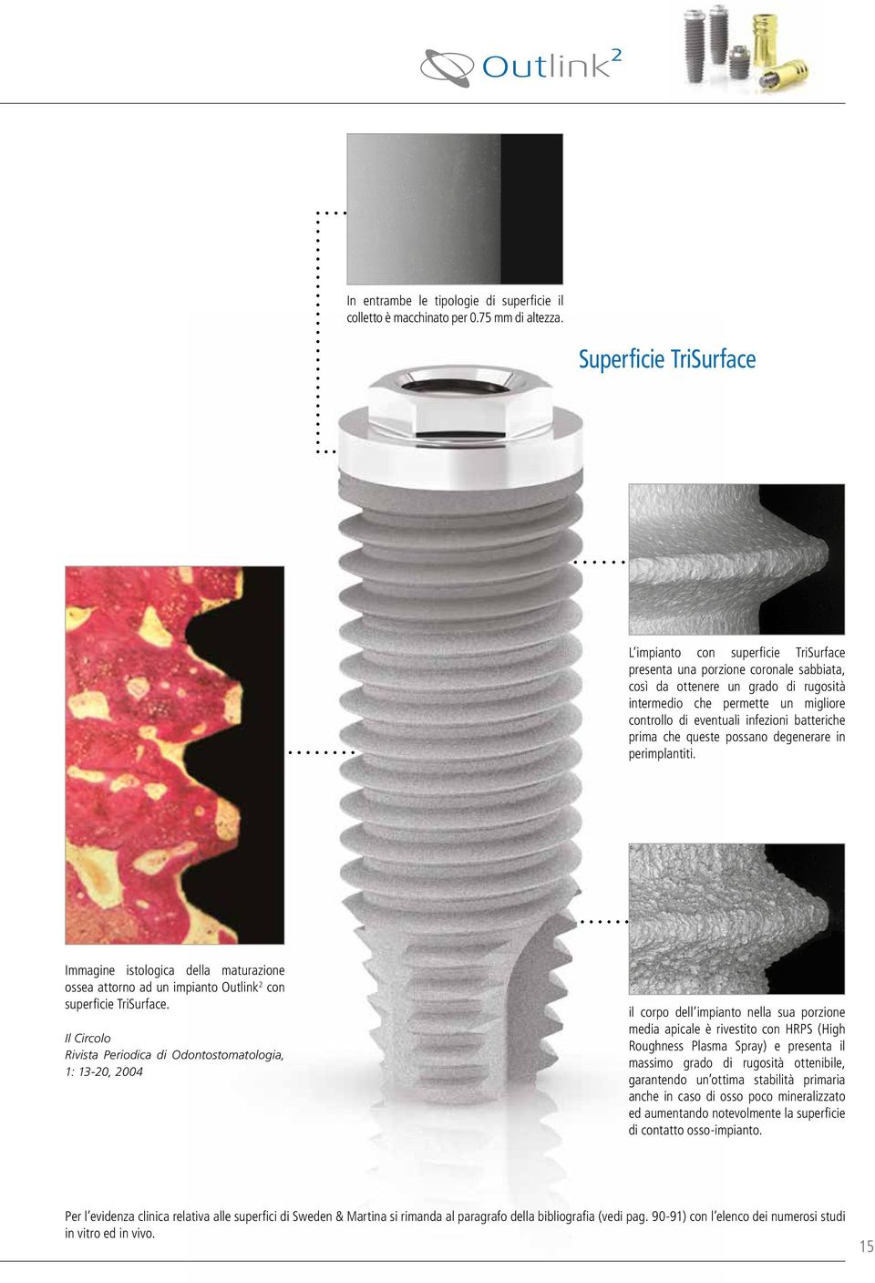 infezioni batteriche prima che queste possano degenerare in perimplantiti. Immagine istologica della maturazione ossea attorno ad un impianto Outlink 2 con superficie TriSurface.