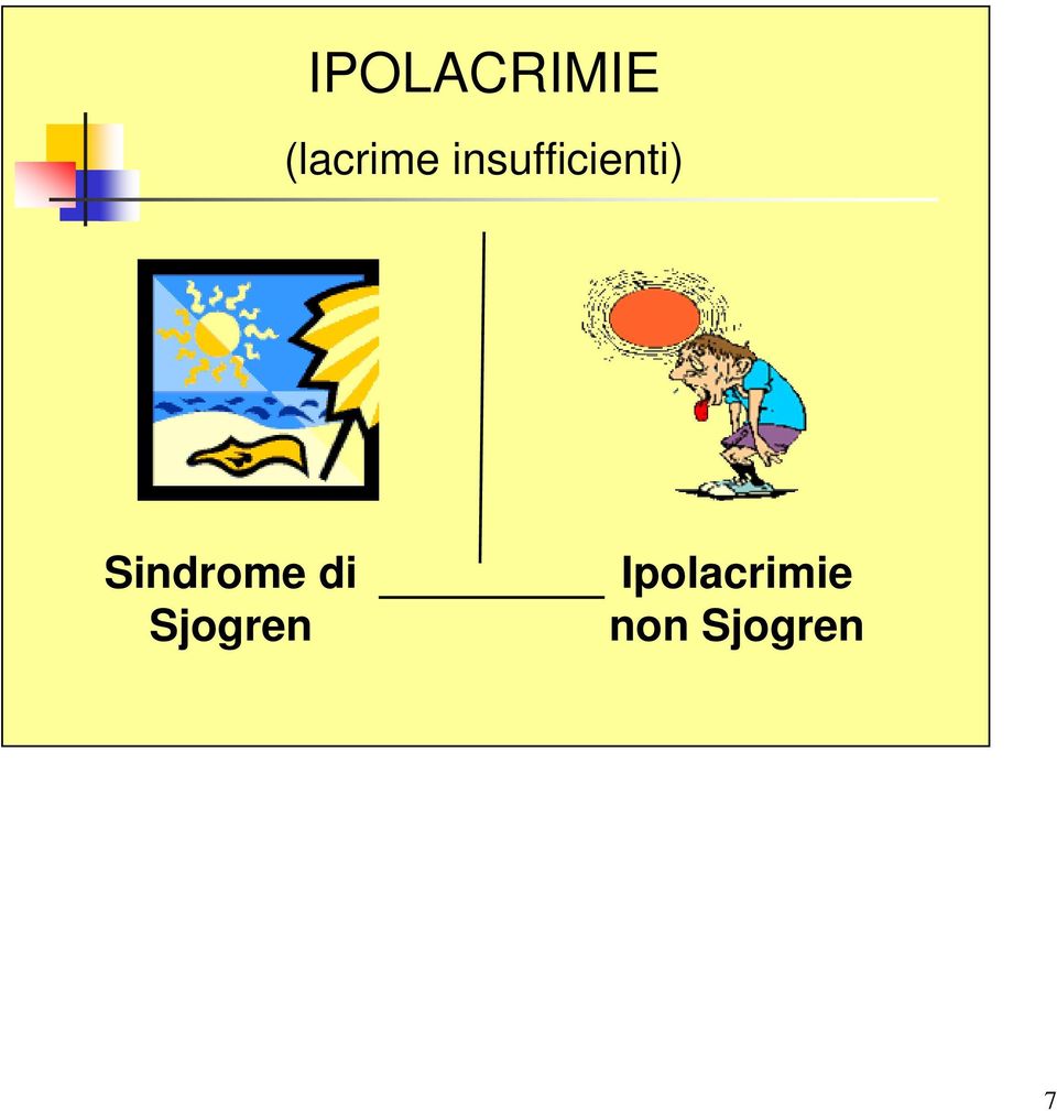 Sindrome di Sjogren