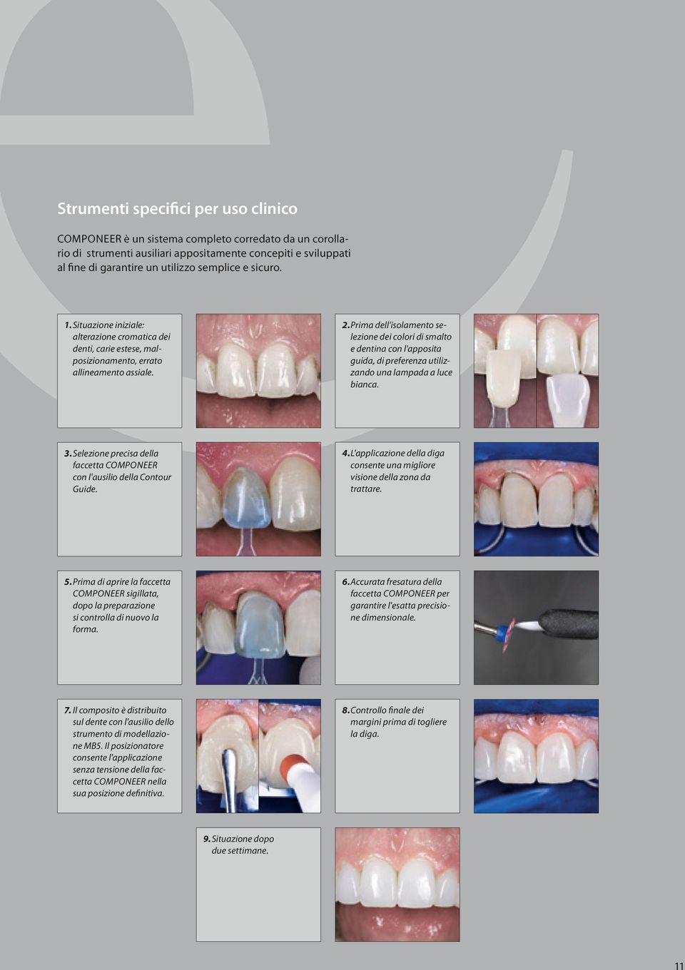 Prima dell'isolamento selezione dei colori di smalto e dentina con l'apposita guida, di preferenza utilizzando una lampada a luce bianca. 3.