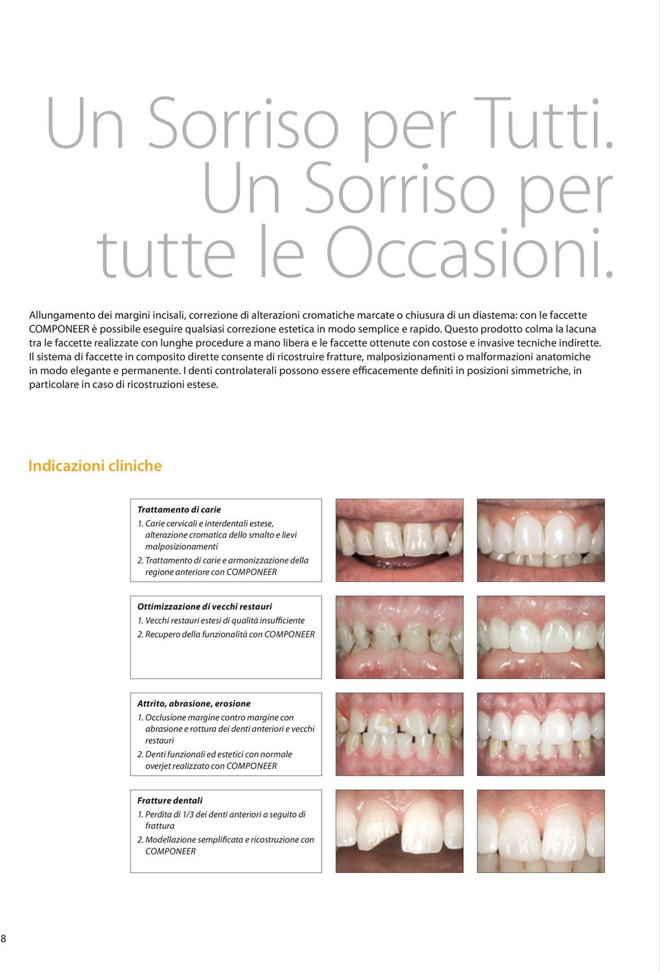 semplice e rapido. Questo prodotto colma la lacuna tra le faccette realizzate con lunghe procedure a mano libera e le faccette ottenute con costose e invasive tecniche indirette.