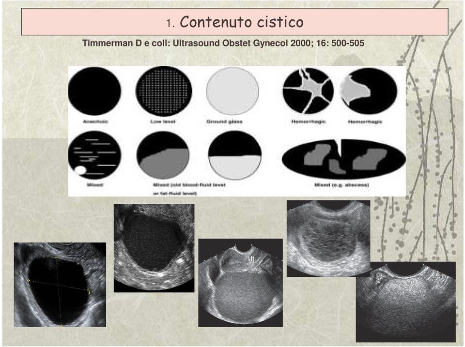 Ultrasound Obstet