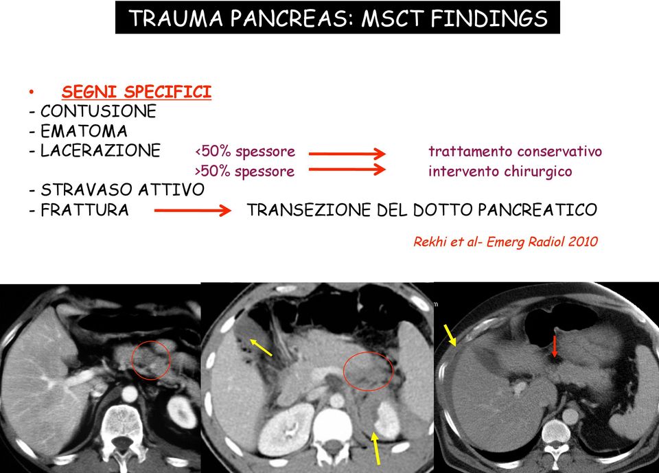 >50% spessore intervento chirurgico - STRAVASO ATTIVO -