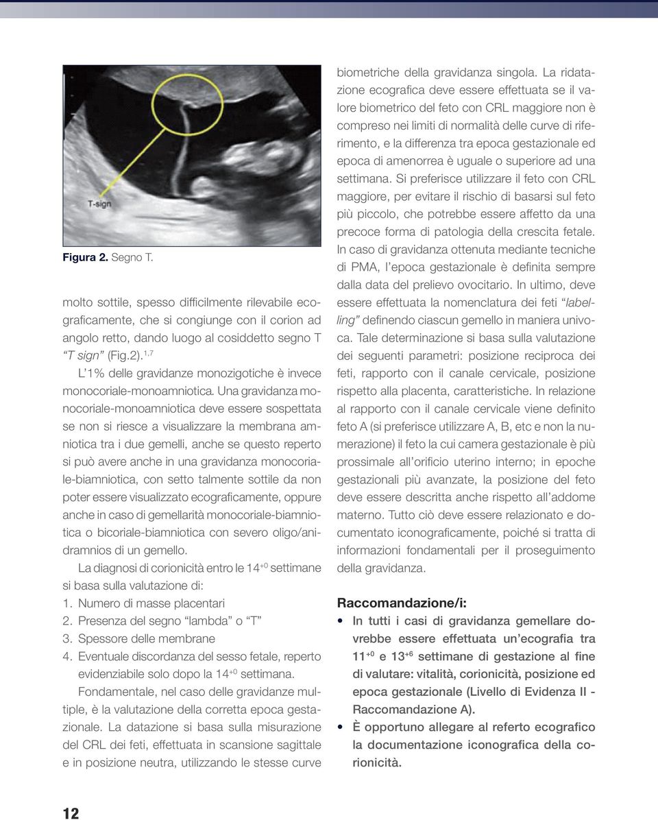 Una gravidanza monocoriale-monoamniotica deve essere sospettata se non si riesce a visualizzare la membrana amniotica tra i due gemelli, anche se questo reperto si può avere anche in una gravidanza