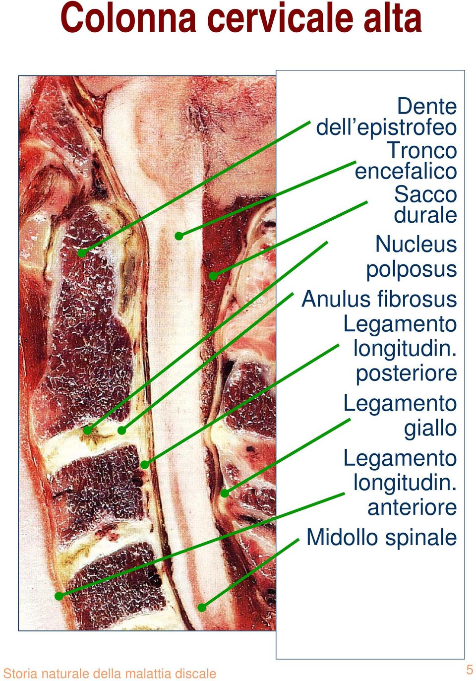 fibrosus longitudin. posteriore giallo longitudin.