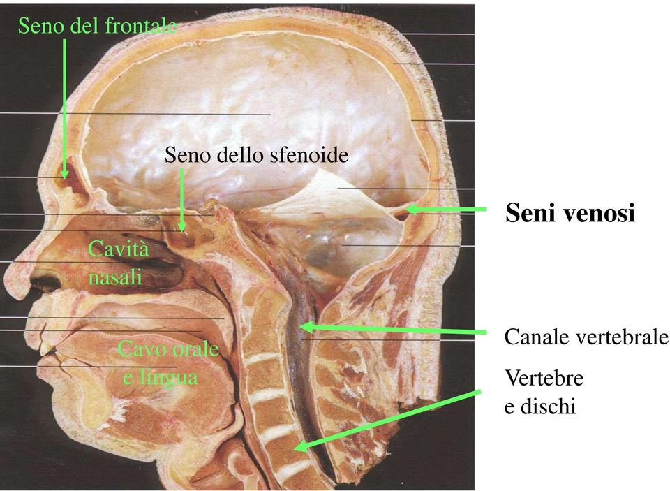 orale e lingua Seni venosi