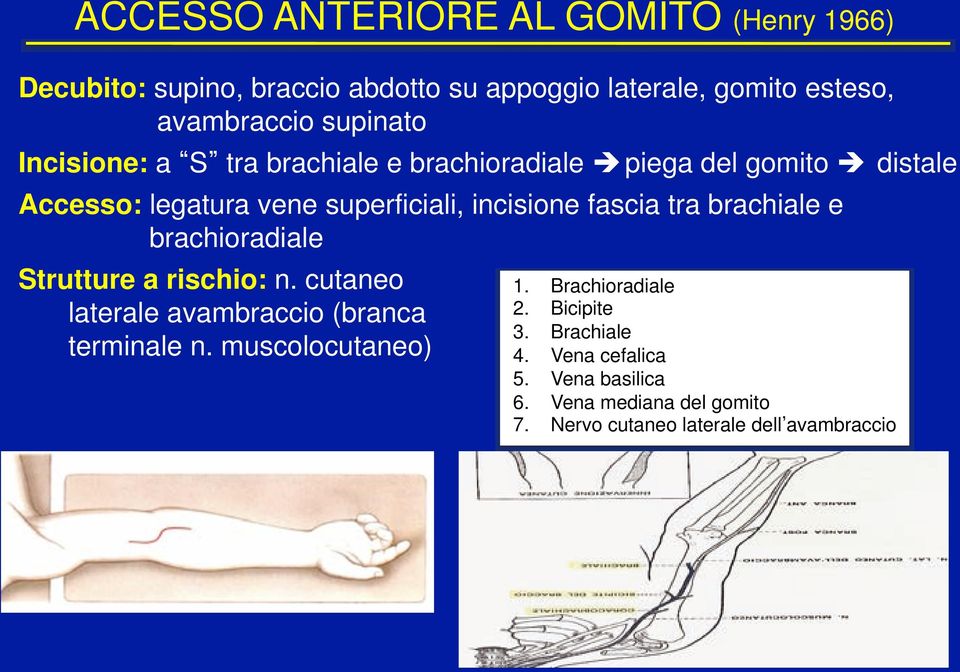 distale Accesso: legatura vene superficiali, incisione fascia tra brachiale e brachioradiale Strutture a rischio: n.