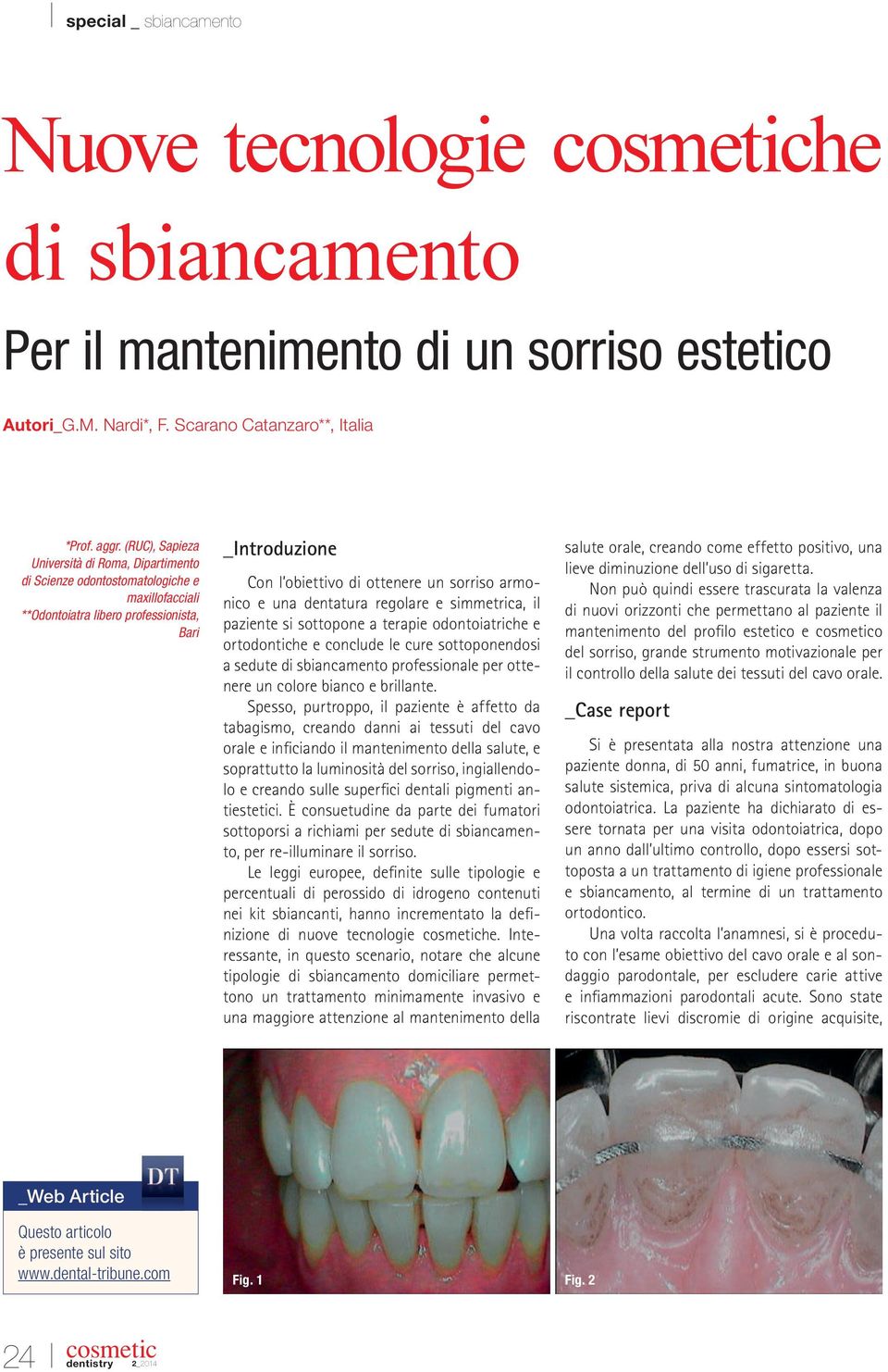 armonico e una dentatura regolare e simmetrica, il paziente si sottopone a terapie odontoiatriche e ortodontiche e conclude le cure sottoponendosi a sedute di sbiancamento professionale per ottenere