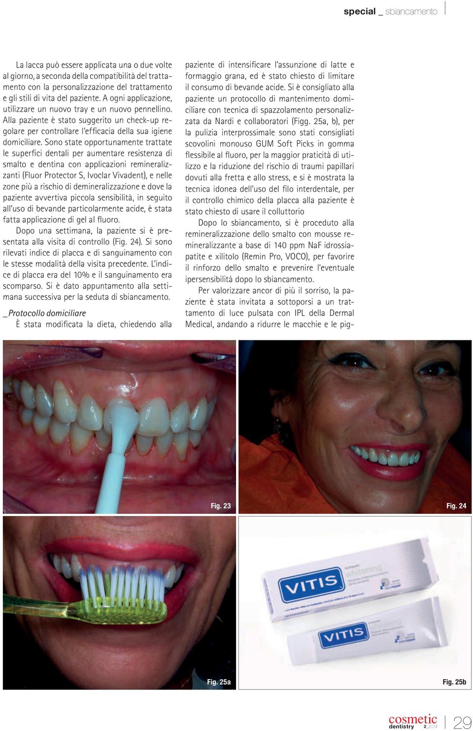 Sono state opportunamente trattate le superici dentali per aumentare resistenza di smalto e dentina con applicazioni remineralizzanti (Fluor Protector S, Ivoclar Vivadent), e nelle zone più a rischio