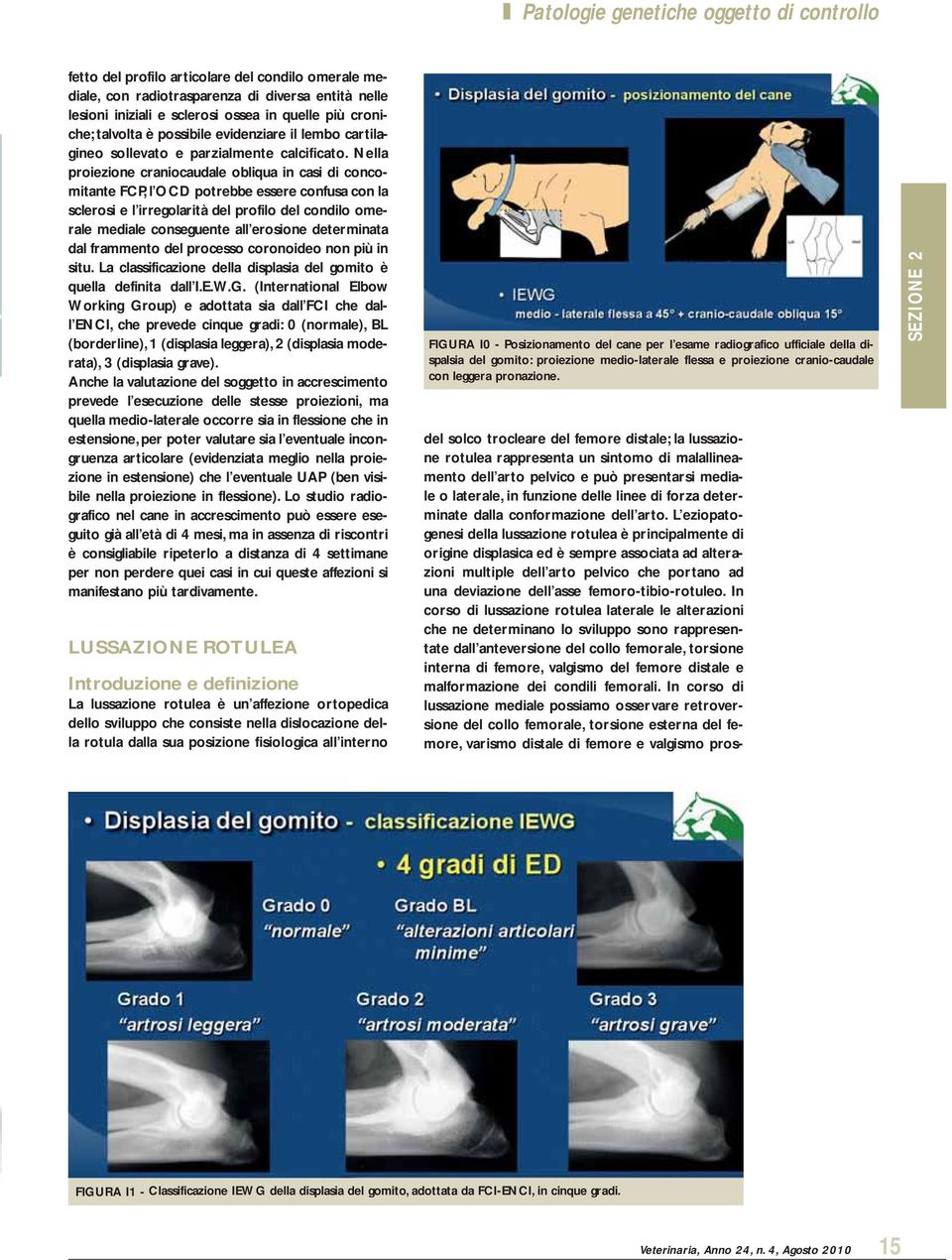 Nella proiezione craniocaudale obliqua in casi di concomitante FCP, l OCD potrebbe essere confusa con la sclerosi e l irregolarità del profilo del condilo omerale mediale conseguente all erosione