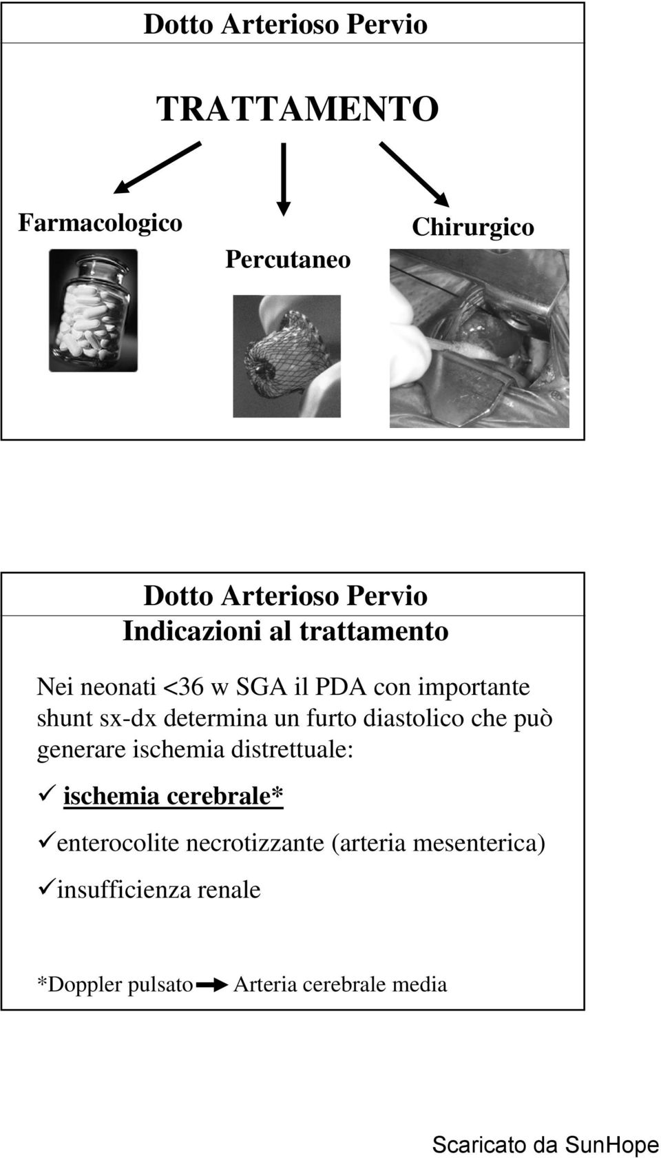 che può generare ischemia distrettuale: ischemia cerebrale* enterocolite