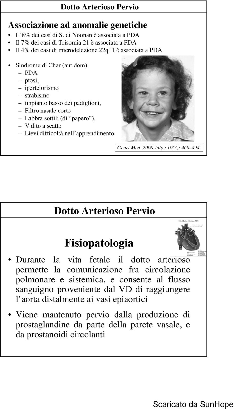 strabismo impianto basso dei padiglioni, Filtro nasale corto Labbra sottili (di papero ), V dito a scatto Lievi difficoltà nell apprendimento. Genet Med. 2008 July ; 10(7): 469 494.