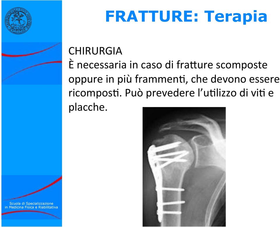 più frammen*, che devono essere