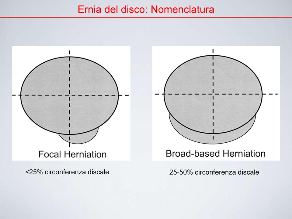 circonferenza discale