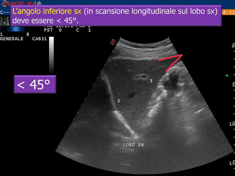 longitudinale sul